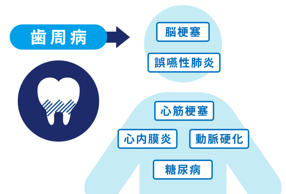 なぜ歯科医療が大事なのか
